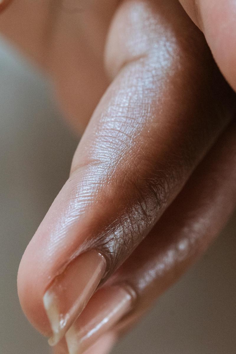 nail fungus-566d3b4633774a1db4ab9fff7bb4b2a0.jpg nail fungus